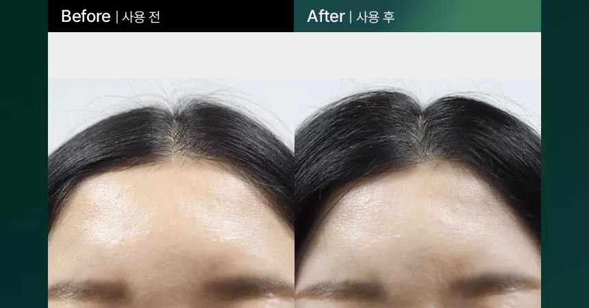 韓國國民級Olive Young🏆 ViveLab Revive Therapy Hair Scalp & Brow Ampoule 活髮再生頭皮修復滾珠安瓶精華