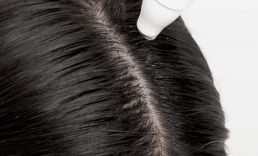 韓國國民級Olive Young🏆 ViveLab Revive Therapy Hair Scalp & Brow Ampoule 活髮再生頭皮修復滾珠安瓶精華