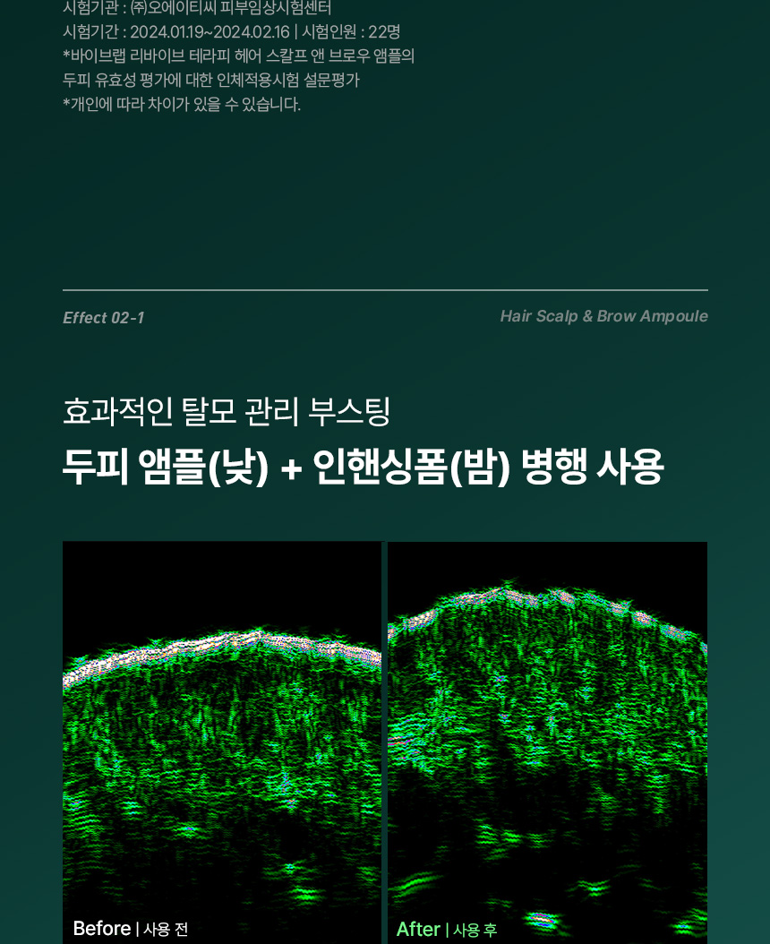 韓國國民級Olive Young🏆 ViveLab Revive Therapy Hair Scalp & Brow Ampoule 活髮再生頭皮修復滾珠安瓶精華