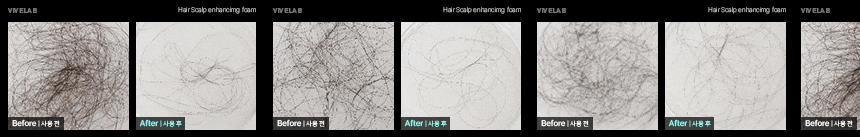 韓國防脫生髮頭皮專家 ViveLab Revive Therapy Hair Scalp Enhancing Foam 煥活頭皮修復高濃縮泡泡營養液 (100ml/33ml) - 2種選擇