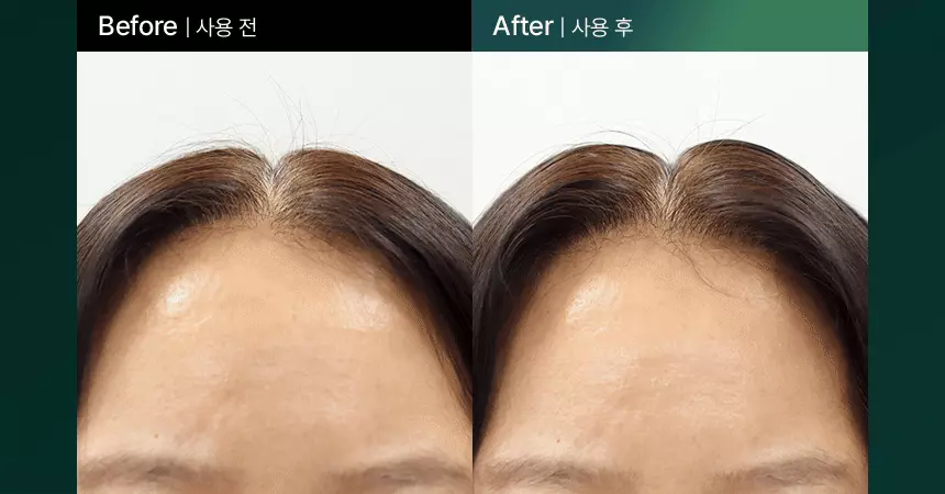 韓國防脫生髮頭皮專家 ViveLab Revive Therapy Hair Scalp Enhancing Foam 煥活頭皮修復高濃縮泡泡營養液 (100ml/33ml) - 2種選擇
