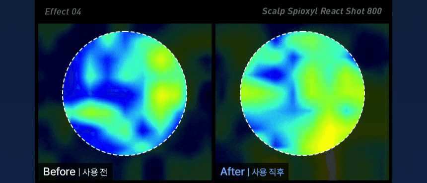 【高效進階版微針】極速滲透8層頭皮~韓國 ViveLab Scalp Spioxyl React Shot 800 99%高純度微針導入煥活頭皮育髮安瓶精華800 - 50 ml