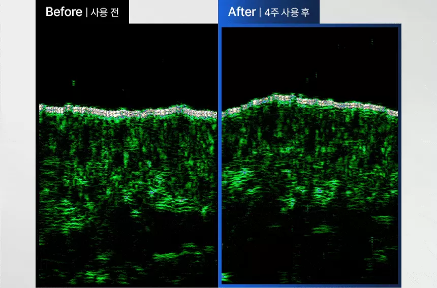 【高效進階版微針】極速滲透8層頭皮~韓國 ViveLab Scalp Spioxyl React Shot 800 99%高純度微針導入煥活頭皮育髮安瓶精華800 - 50 ml