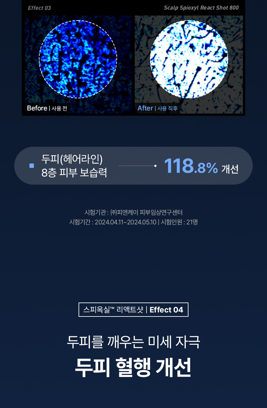 【高效進階版微針】極速滲透8層頭皮~韓國 ViveLab Scalp Spioxyl React Shot 800 99%高純度微針導入煥活頭皮育髮安瓶精華800 - 50 ml
