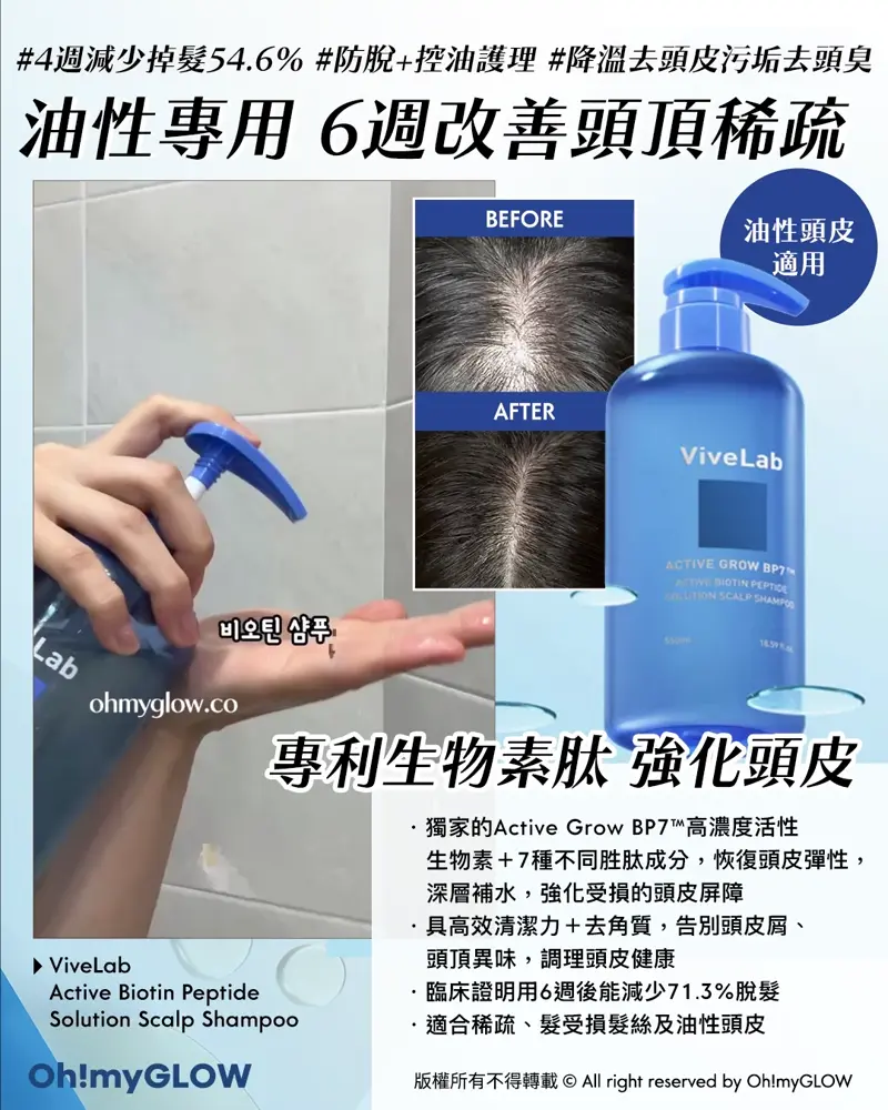 再見塌塌頭👋🏻❣️韓國No.1防脫髮救星😎💫ViveLab育髮專家🌱|100%有效改善頭皮健康💚髮量增倍零難度🧴
\ 油性專用💙 𝟲週改善頭頂稀疏 /
📍 ViveLab|Active Biotin Peptide Solution Scalp Shampoo