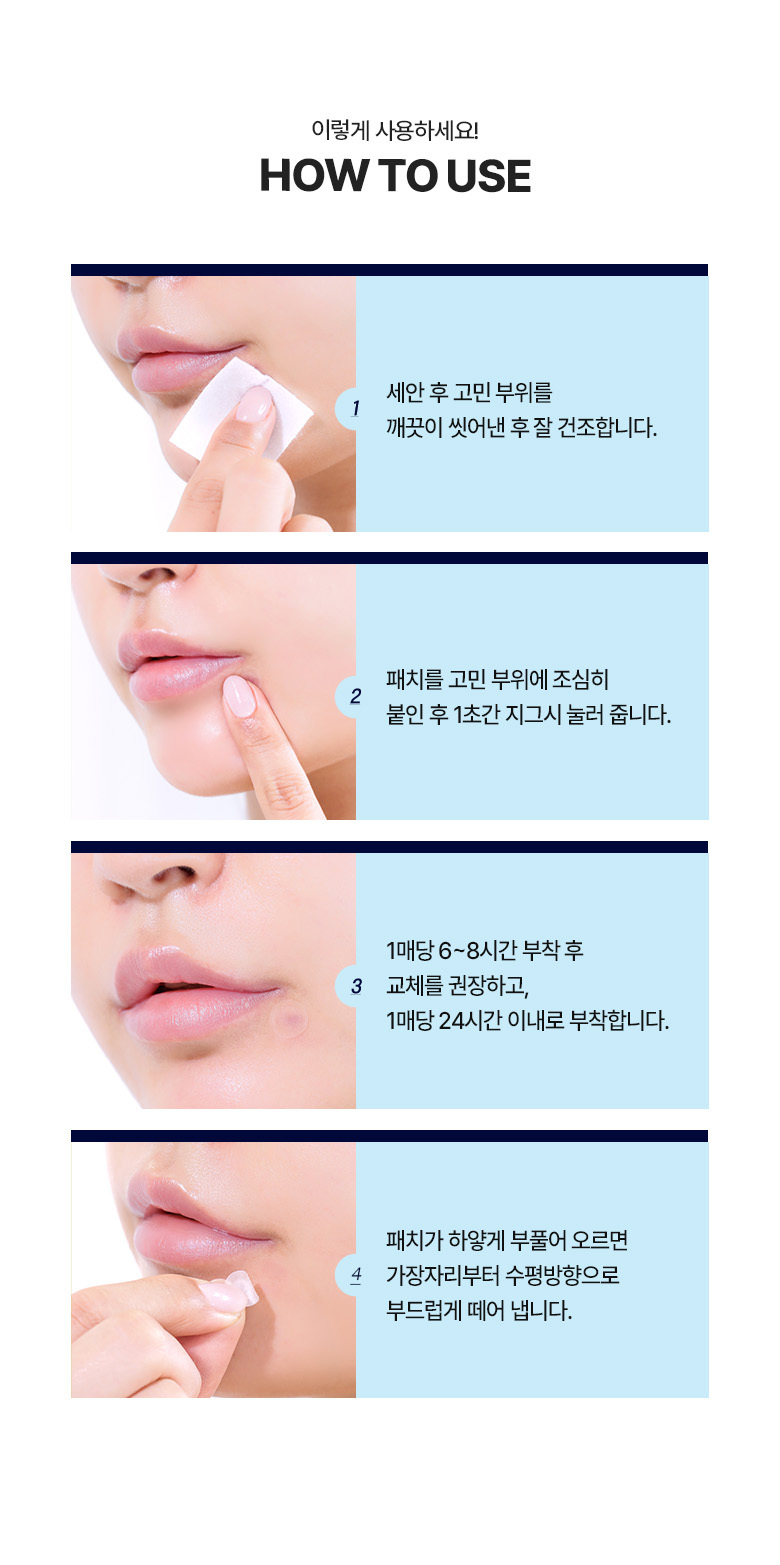 Olive Young 4年No.1 🏆皇牌得奬暗瘡貼～韓國 Care Plus Scar Cover Spot Patch 消痘暗瘡貼 102片裝