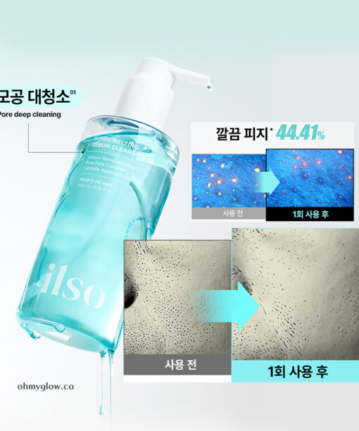 用一次黑頭、皮脂即改善～韓國 ilso Super Melting Sebum Cleansing Oil 溶毛孔油脂清黑頭卸妝油 - 200ml