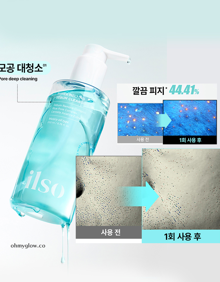 用一次黑頭、皮脂即改善～韓國 ilso Super Melting Sebum Cleansing Oil 溶毛孔油脂清黑頭卸妝油 - 200ml