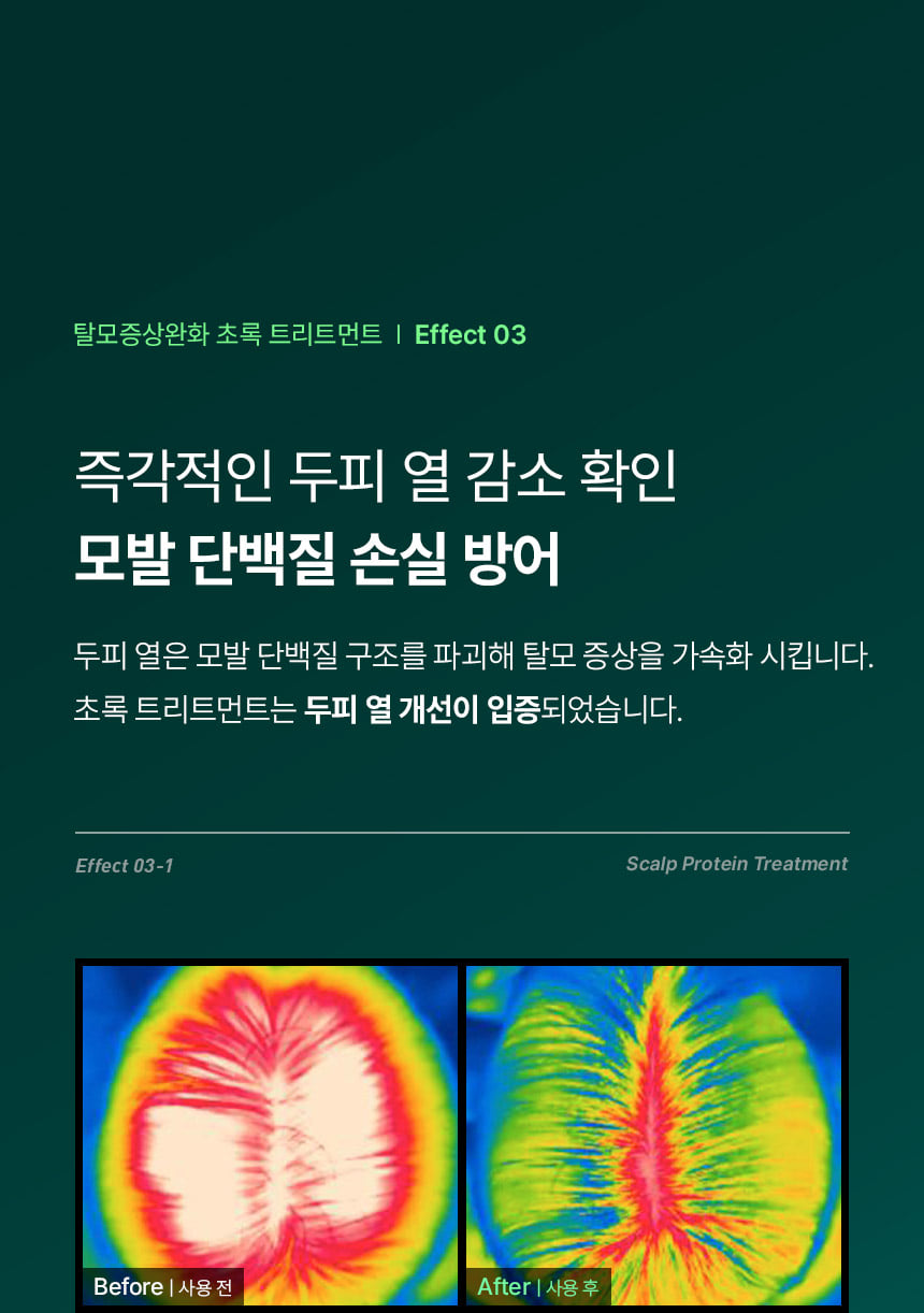 韓國 ViveLab Revi Solution Anti Hair Loss Scalp Protein Treatment 防脫強髮絲護頭皮蛋白護髮素 - 200ml