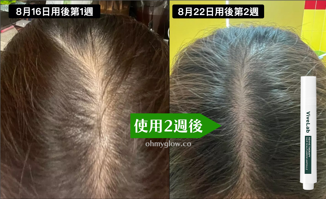 韓國國民級Olive Young🏆 ViveLab Revive Therapy Hair Scalp & Brow Ampoule 涼感活髮再生頭皮修復滾珠安瓶精華