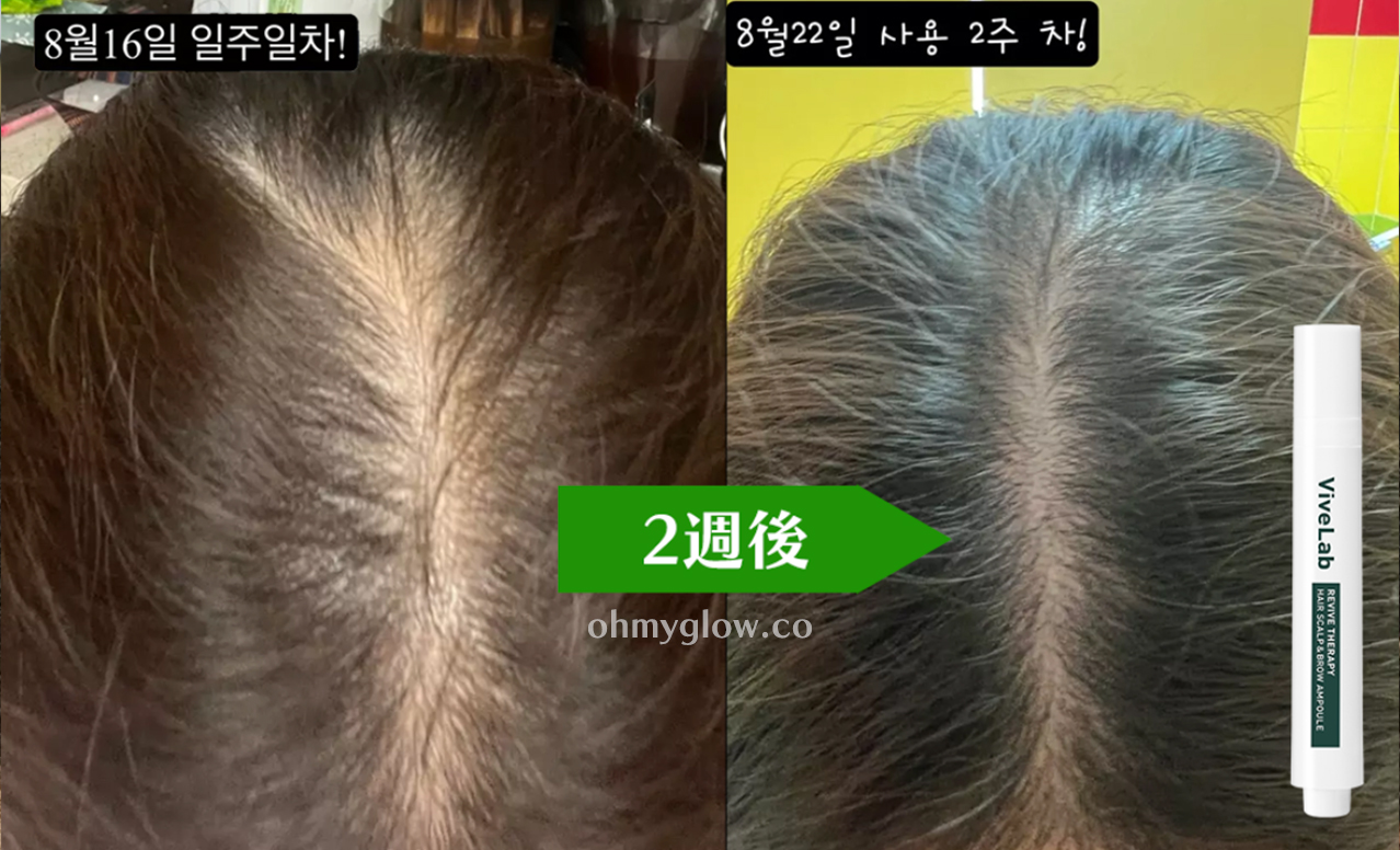 韓國國民級Olive Young🏆 ViveLab Revive Therapy Hair Scalp & Brow Ampoule 涼感活髮再生頭皮修復滾珠安瓶精華