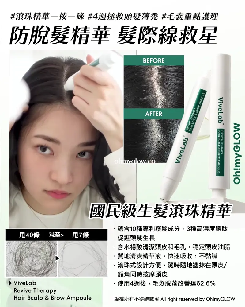 再見塌塌頭👋🏻❣️韓國No.1防脫髮救星😎💫ViveLab育髮專家🌱|100%有效改善頭皮健康💚髮量增倍零難度🧴 \ 髮際線救星 國民級生髮滾珠精華⚪ /
📍 ViveLab | Revive Therapy Hair Scalp & Brow Ampoule