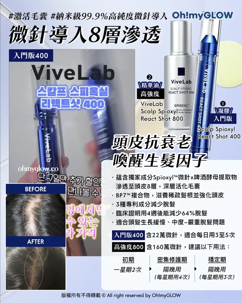 再見塌塌頭👋🏻❣️韓國No.1防脫髮救星😎💫ViveLab育髮專家🌱|100%有效改善頭皮健康💚髮量增倍零難度🧴
\ 微針導入𝟴層滲透 頭皮抗衰老 喚醒生髮因子💉 /
❶ ViveLab Scalp Spioxyl React Shot 400(入門版)
❷ ViveLab Scalp Spioxyl React Shot 800(高強度)