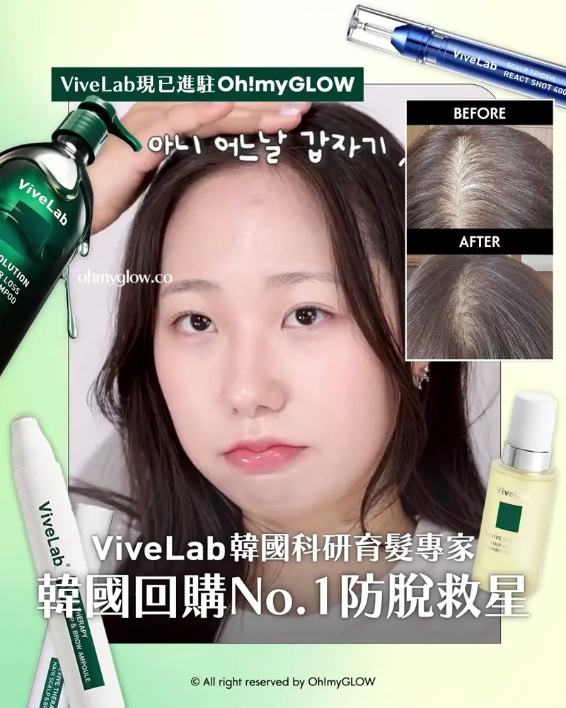 再見塌塌頭👋🏻❣️韓國No.1防脫髮救星😎💫ViveLab育髮專家🌱|100%有效改善頭皮健康💚髮量增倍零難度🧴