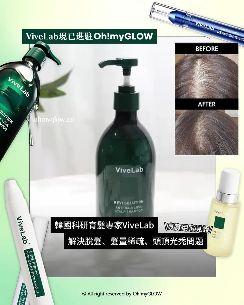 再見塌塌頭👋🏻❣️韓國No.1防脫髮救星😎💫ViveLab育髮專家🌱|100%有效改善頭皮健康💚髮量增倍零難度🧴