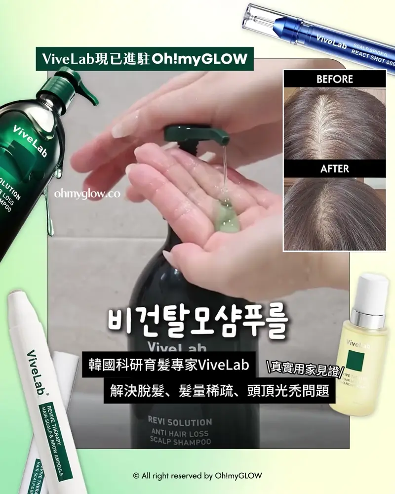 再見塌塌頭👋🏻❣️韓國No.1防脫髮救星😎💫ViveLab育髮專家🌱|100%有效改善頭皮健康💚髮量增倍零難度🧴
