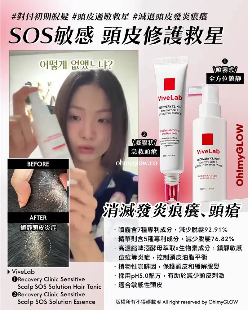 再見塌塌頭👋🏻❣️韓國No.1防脫髮救星😎💫ViveLab育髮專家🌱|100%有效改善頭皮健康💚髮量增倍零難度🧴
\ 𝗦𝗢𝗦敏感 頭皮修護救星🆘 /
❶ ViveLab Recovery Clinic Sensitive Scalp SOS Solution Hair Tonic(噴霧式)
❷ ViveLab Recovery Clinic Sensitive Scalp SOS Solution Essence(凝膠狀)