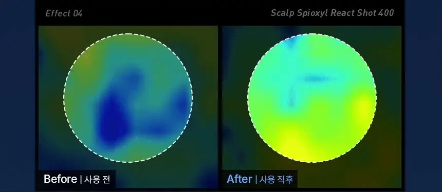 【溫和入門版微針】極速滲透8層頭皮~韓國 ViveLab Spioxyl React Shot 400 99%高純度微針導入煥活頭皮育髮安瓶精華400 - 15ml