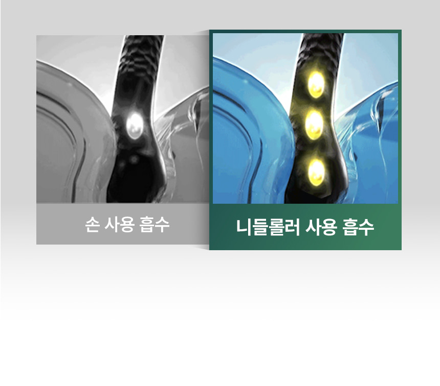 刺激頭皮循環&吸收～韓國 ViveLab Needle Roller 專業頭皮微針滾輪