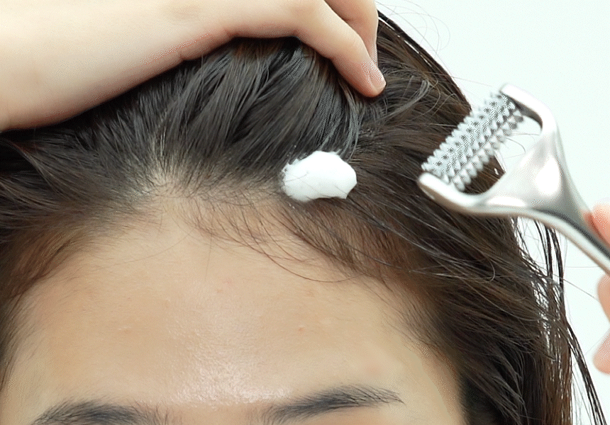 刺激頭皮循環&吸收～韓國 ViveLab Needle Roller 專業頭皮微針滾輪