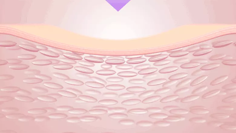 【買5享6】韓國 BioHeal BOH Probioderm Collagen Remodeling Serum Mask 益生菌膠原蛋白重塑緊緻毛孔精華面膜(單片/多片) – 多種選擇