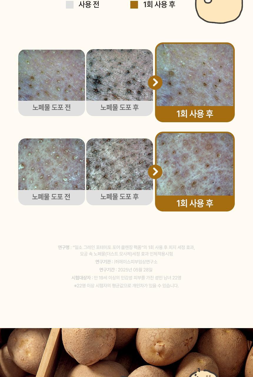 限量1＋1套裝【送🏆得奬潔面刷 + 貼紙】面膜 X 潔面2合1~韓國 ilso Grain Potato Pore Cleansing Pack Foam Set  🥔馬鈴薯穀物酵素深清毛孔面膜Q彈泡泡潔面 - 150ml