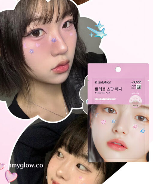 暗瘡Sticker Patch~ 韓國 Daiso X A Solution Trouble Spot Patch 舒緩痘痘暗瘡貼 - 57片裝