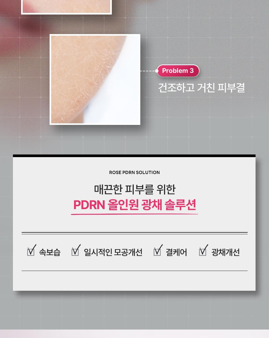 【OY 限量10片送1片】銷量王🏆 韓國 MEDIHEAL Essential Mask Pack 10+1 Sheets 皇牌得奬精華面膜 (Madecassoside / Rose PDRN/ Tea Tree/ Hyaluronic Acid/ Collagen/ Vitamin/ Ceramide) - 7種選擇