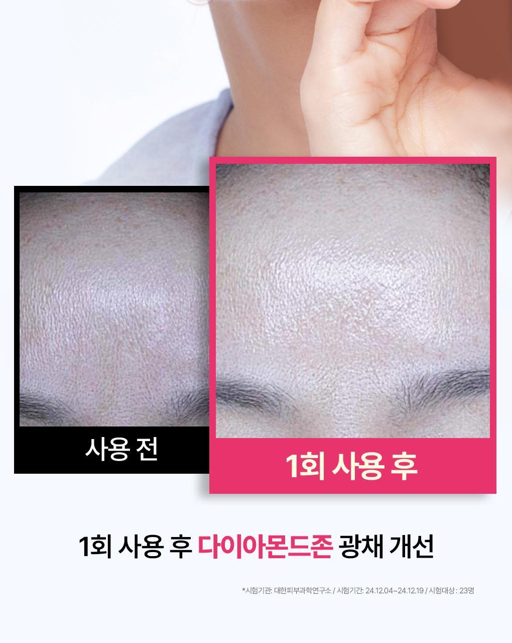 【OY 限量10片送1片】銷量王🏆 韓國 MEDIHEAL Essential Mask Pack 10+1 Sheets 皇牌得奬精華面膜 (Madecassoside / Rose PDRN/ Tea Tree/ Hyaluronic Acid/ Collagen/ Vitamin/ Ceramide) - 7種選擇