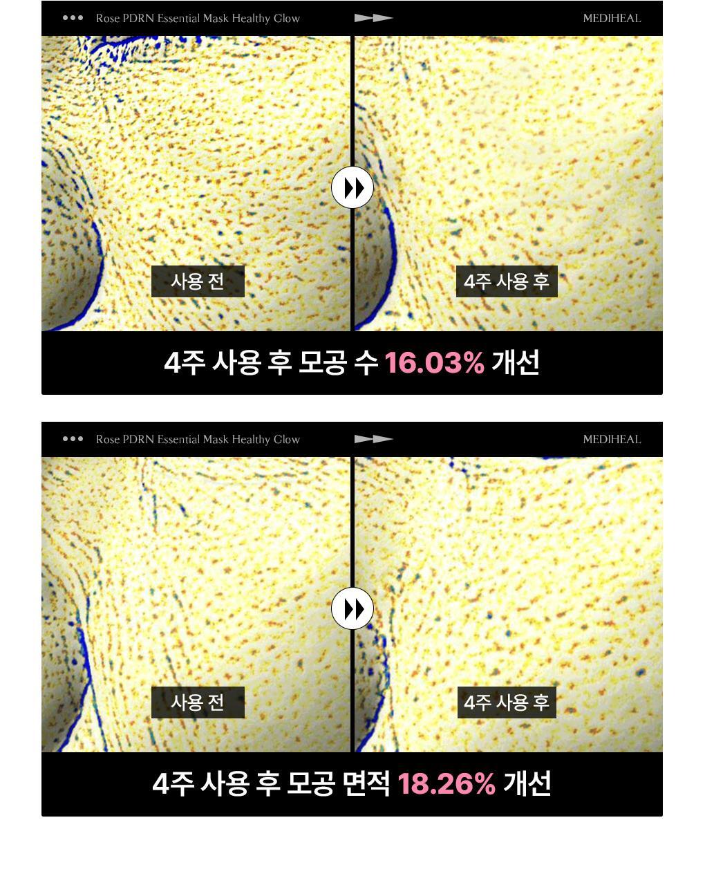 【OY 限量10片送1片】銷量王🏆 韓國 MEDIHEAL Essential Mask Pack 10+1 Sheets 皇牌得奬精華面膜 (Madecassoside / Rose PDRN/ Tea Tree/ Hyaluronic Acid/ Collagen/ Vitamin/ Ceramide) - 7種選擇