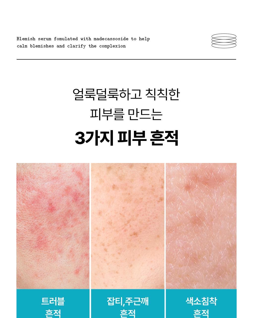 【OY🏆限量40ml+40ml+10ml套裝】 韓國 MEDIHEAL Madecassoside Blemish Repair Serum 98%純積雪草提亮淡斑修復精華