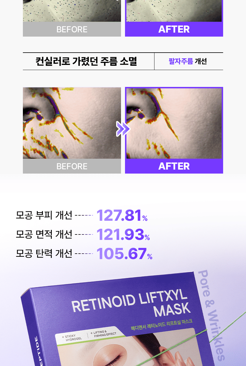 INBORA推介面膜！GlowPick🏆 韓國 MediAnswer Retinoid Liftxyl Mask 高效能溫和第四代視黃醇緊緻提拉絲線凝膠面膜(1盒4片/單片散裝) - 2種選擇