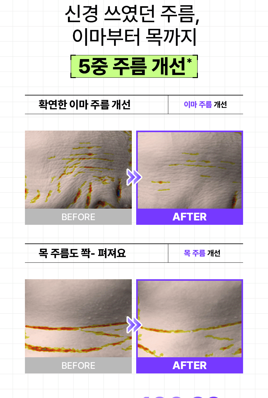INBORA推介萬能緊緻精華!韓國 MediAnswer Retinoid Liftxyl Serum 高效能溫和第四代維A HPR 緊緻提拉絲線精華 - 30ml