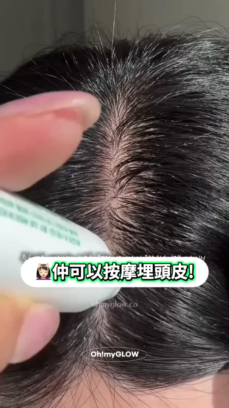 我明啊sis，但成日戴帽都唔係辦法😌​🧢​！頭頂+髮界自救育髮法寶GET 韓國Olive Young得奬科研育髮護頭皮滾珠精華 ViveLabヽ(●´ε｀●)ノ💚