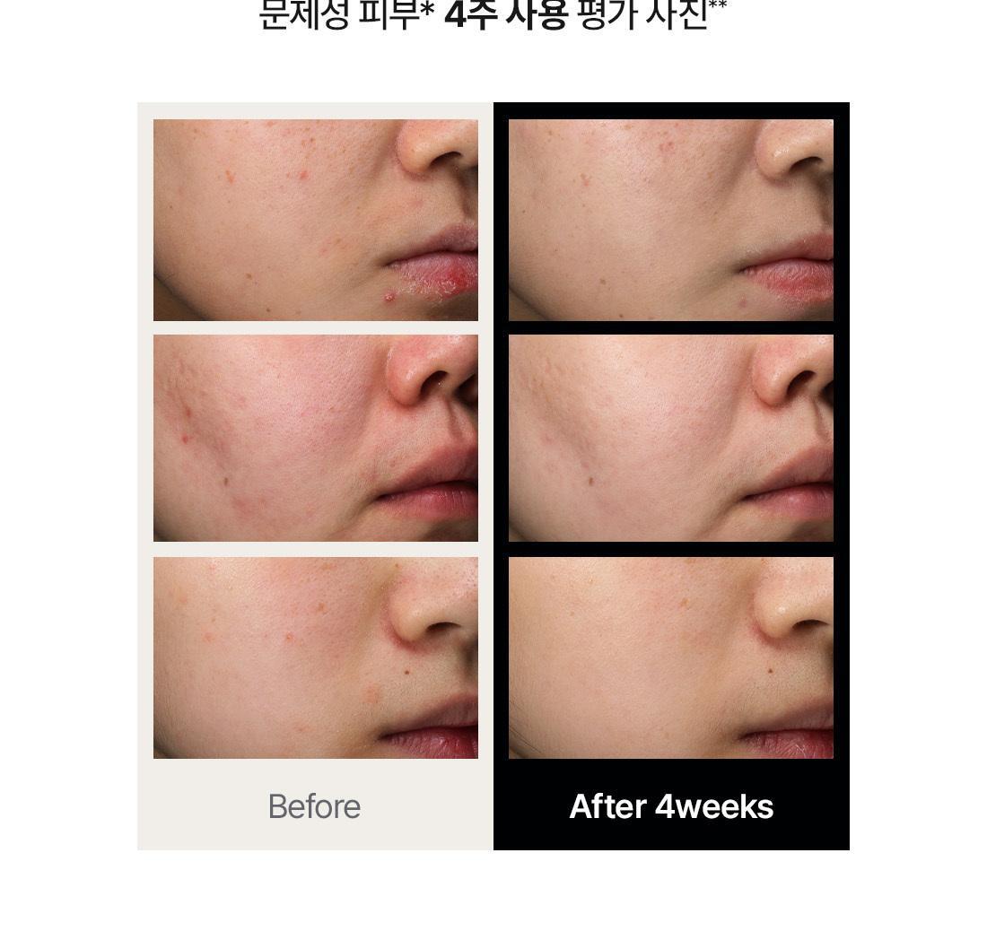 韓國 OY No.1🏆超人氣面霜～Dr.Althea 345 Relief Cream 50ml 舒緩修護淡痘印面霜 - 50ml