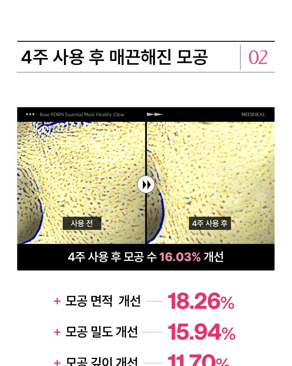 【OY 限量10片送1片】韓國 Mediheal Essential Mask Pack #Rose PDRN 植萃玫瑰PDRN毛孔煥亮彈力緊緻面膜 - 1盒11片