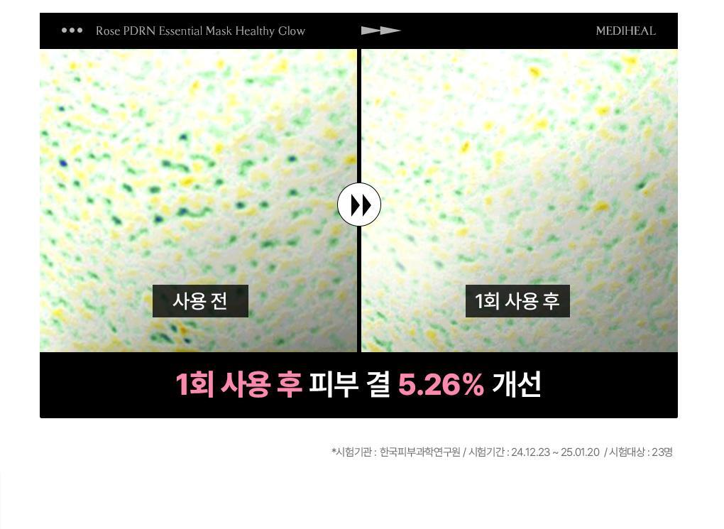 【OY 限量10片送1片】韓國 Mediheal Essential Mask Pack #Rose PDRN 植萃玫瑰PDRN毛孔煥亮彈力緊緻面膜 - 1盒11片