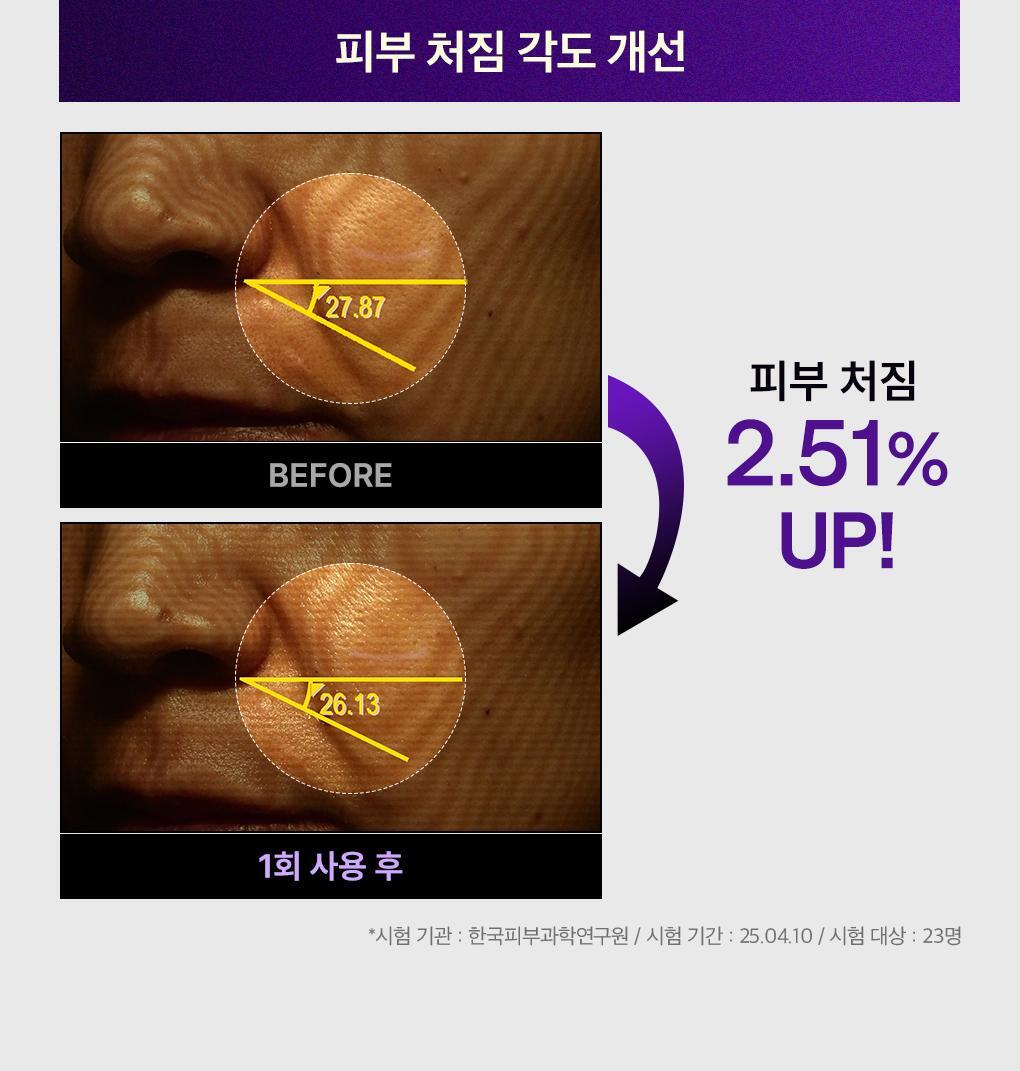 【限量1+1 Set】韓國 Mediheal PDRN Pore Lifting Serum 保加利亞白玫瑰PDRN毛孔彈力提升精華 限定優惠套裝 - 40ml x 2