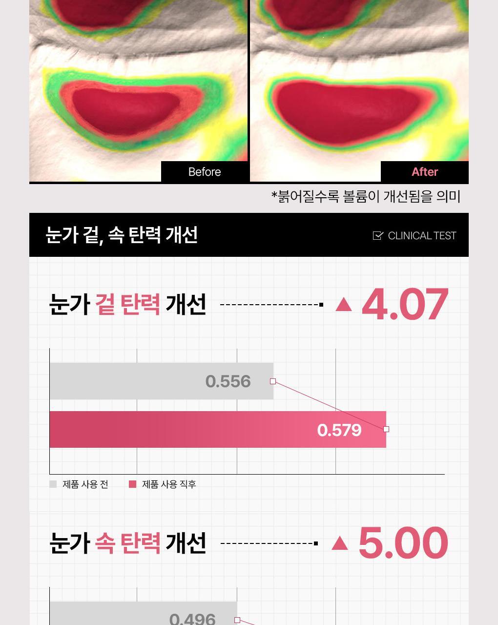 【限量1＋1套裝】韓國 Mediheal Retinol Collagen Capsule Patch 維A X PDRN X 膠原膠囊緊緻減紋減凹陷去浮腫眼膜 - 60+60片