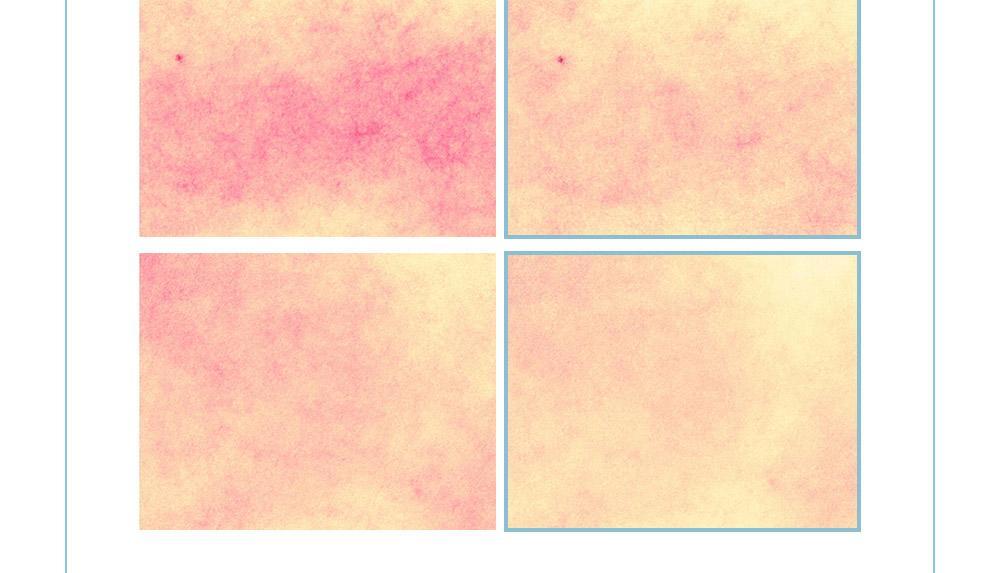 太妍愛用保濕霜 超溫和保濕~🏆 韓國 ATOPALM Panthenol Cream 泛醇深層修護舒緩保濕霜 - 80ml