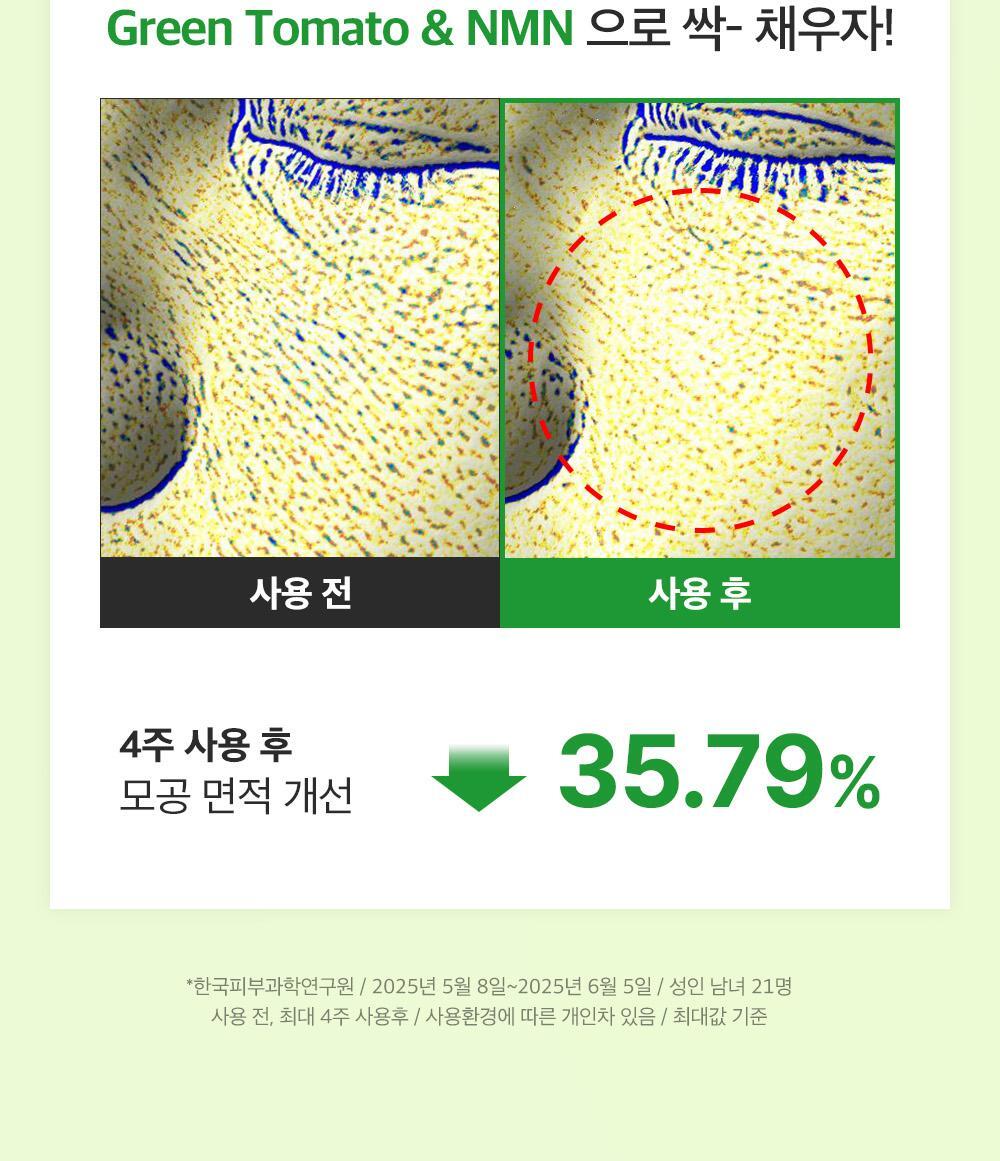 新升級💚 韓國 Sungboon Editor Green Tomato NMN Pore Peeling Pad 綠番茄💚NMN緊緻收毛孔角質護理爽膚棉片- 60片裝