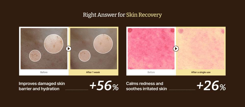 〖韓國藥房熱賣〗新版增量～韓國 Dr Rejuall Advanced PDRN Relief Cream 醫美級麗珠蘭成份高濃度PDRN再生修復霜 - 30ml