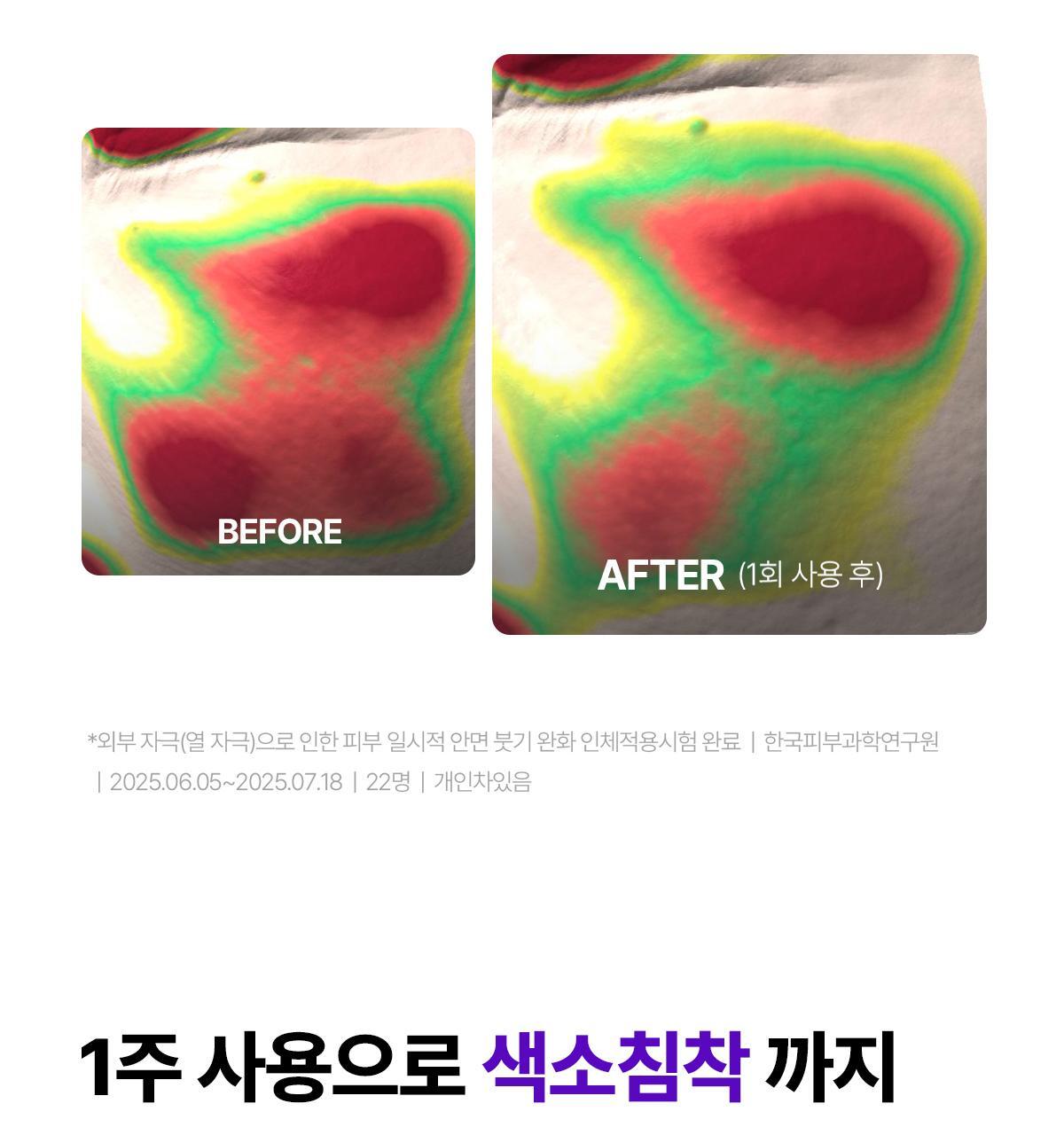 【限量1+1 送15ml旅行裝】韓國 東國製藥出品 Centellian24 Expert Madeca Cream Active Renew PDRN Set 醫美術後5重PDRN活性修護霜 套裝 - 50ml+15ml