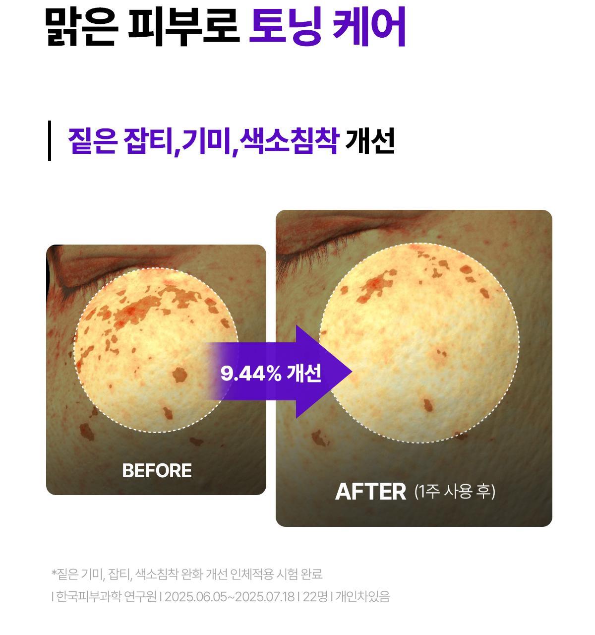 【限量1+1 送15ml旅行裝】韓國 東國製藥出品 Centellian24 Expert Madeca Cream Active Renew PDRN Set 醫美術後5重PDRN活性修護霜 套裝 - 50ml+15ml