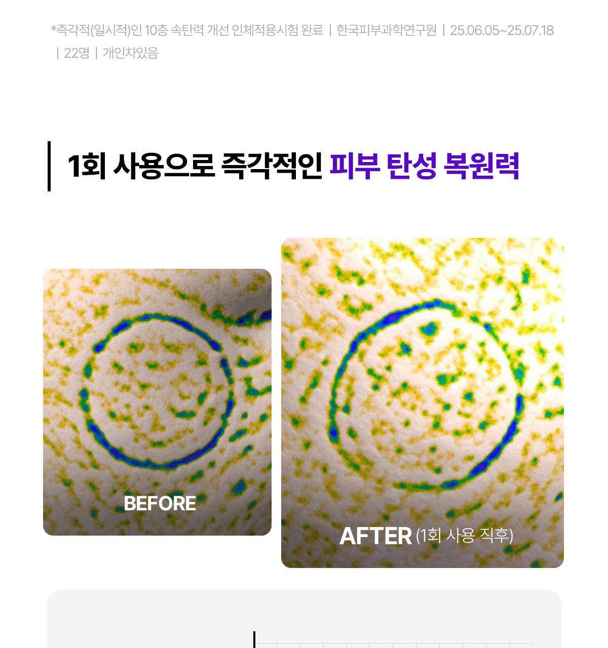 【限量1+1 送15ml旅行裝】韓國 東國製藥出品 Centellian24 Expert Madeca Cream Active Renew PDRN Set 醫美術後5重PDRN活性修護霜 套裝 - 50ml+15ml