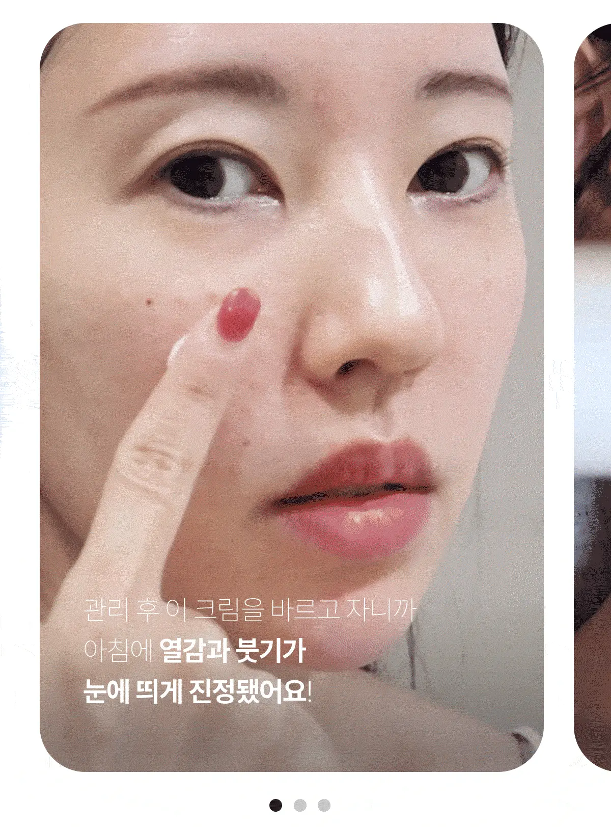 【限量1+1 送15ml旅行裝】韓國 東國製藥出品 Centellian24 Expert Madeca Cream Active Renew PDRN Set 醫美術後5重PDRN活性修護霜 套裝 - 50ml+15ml