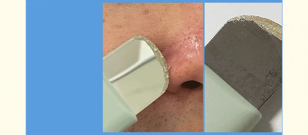 【限量聯名SET 送棉片+黑頭刮刮棒】韓國 ilso x 망그러진곰 Softener Gift Set 黑頭粉刺導出液優惠SET 連深清刮刮棒+棉片