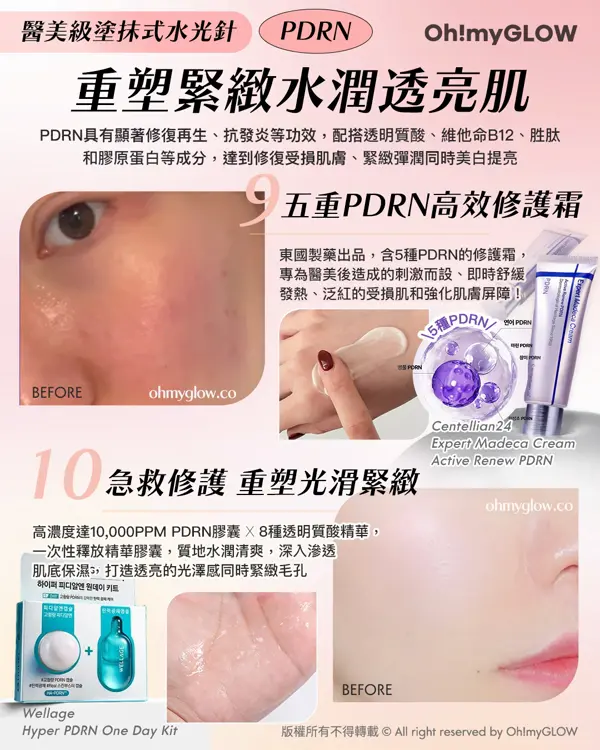 韓國超Hit 護膚都講含金量 醫美級護膚成分 極緻活顏魚子醬PDRN 等 重塑緊緻水潤透亮肌