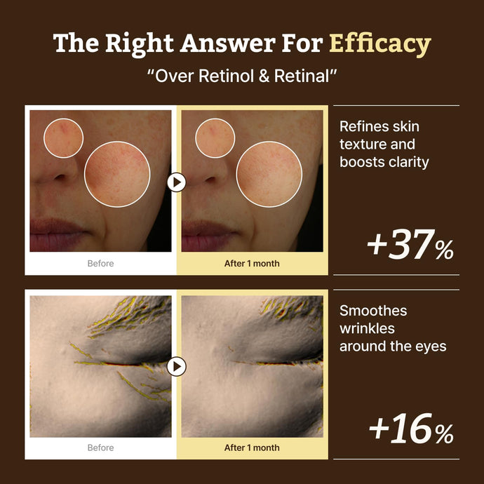 韓國藥房熱賣推介~Dr. Reju-All Advanced Retino-Mela Serum 新世代 HPR X 10% 維B3 X 傅明酸 肌膚再生淡瑕淡紋精華 - 50ml 韓國藥房熱賣推介~Dr. Reju-All Advanced Retino-Mela Serum 新世代 HPR X 10% 維B3 X 傅明酸 肌膚再生淡瑕淡紋精華 - 50ml