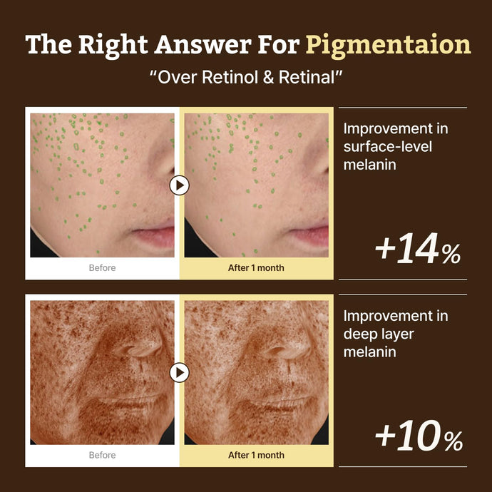 韓國藥房熱賣推介~Dr. Reju-All Advanced Retino-Mela Serum 新世代 HPR X 10% 維B3 X 傅明酸 肌膚再生淡瑕淡紋精華 - 50ml 韓國藥房熱賣推介~Dr. Reju-All Advanced Retino-Mela Serum 新世代 HPR X 10% 維B3 X 傅明酸 肌膚再生淡瑕淡紋精華 - 50ml